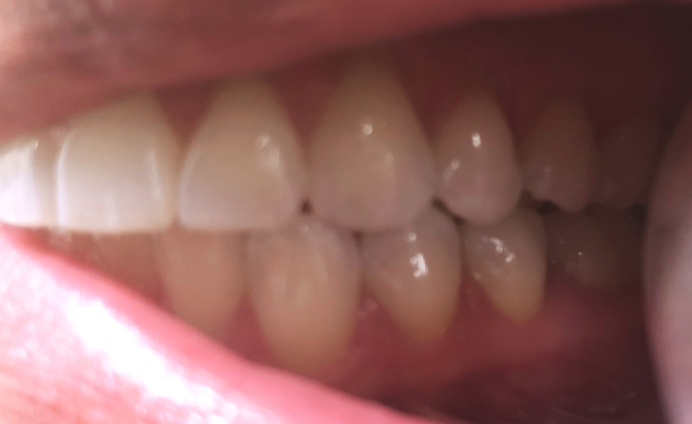 Virtual Smile Consult Hamer & Glassick Orthodontics Charlottesville