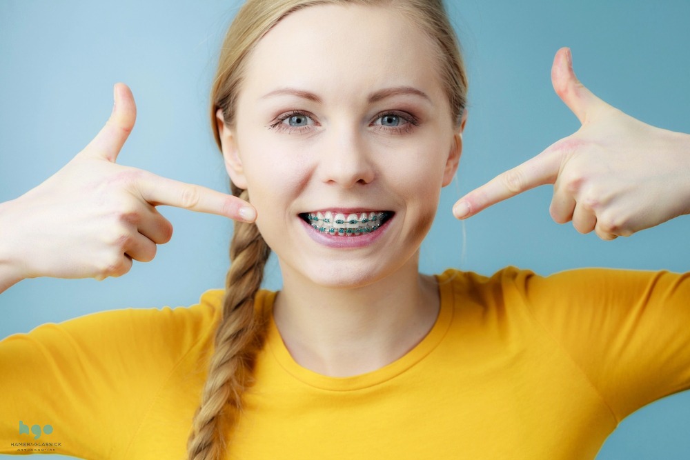 Happy young woman in a yellow sweater pointing at her metal braces as one of her choices between aligners vs braces in charlottesville, va