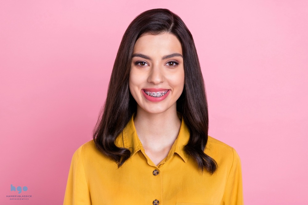 a woman with metal braces smiling at the camera after understanding how long do braces take in charlottesville, va