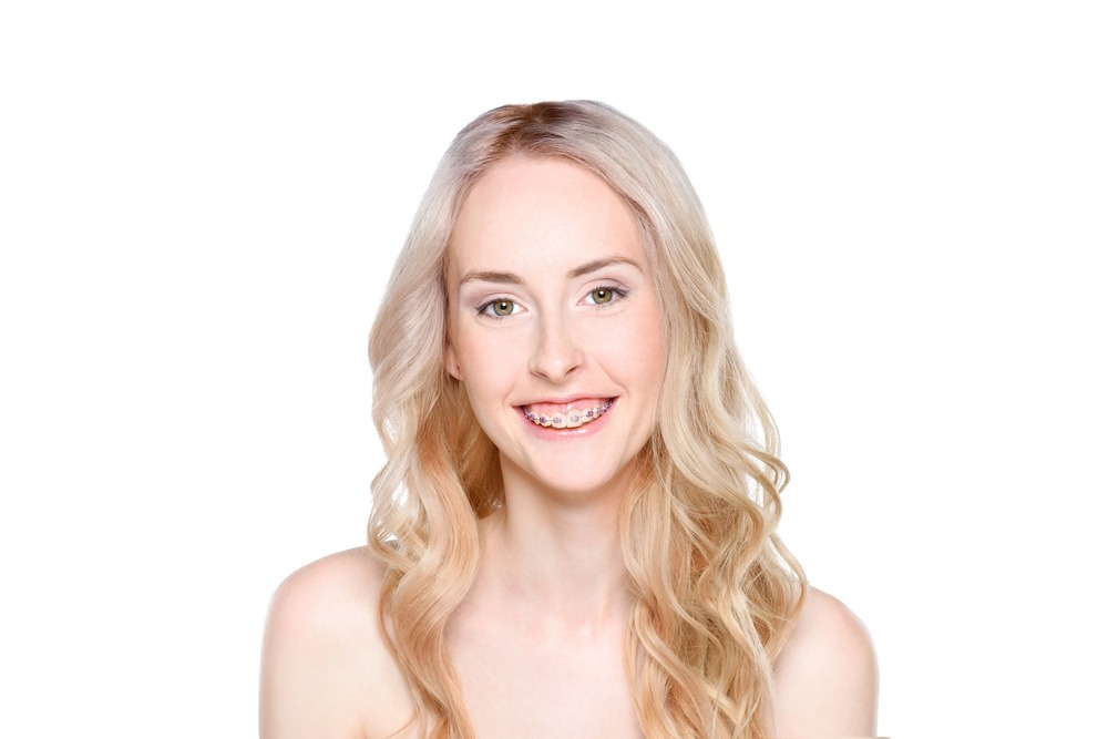 Smiling blonde woman showing straight teeth—confident results after discovering how braces for overbite inm charlottesville, va works