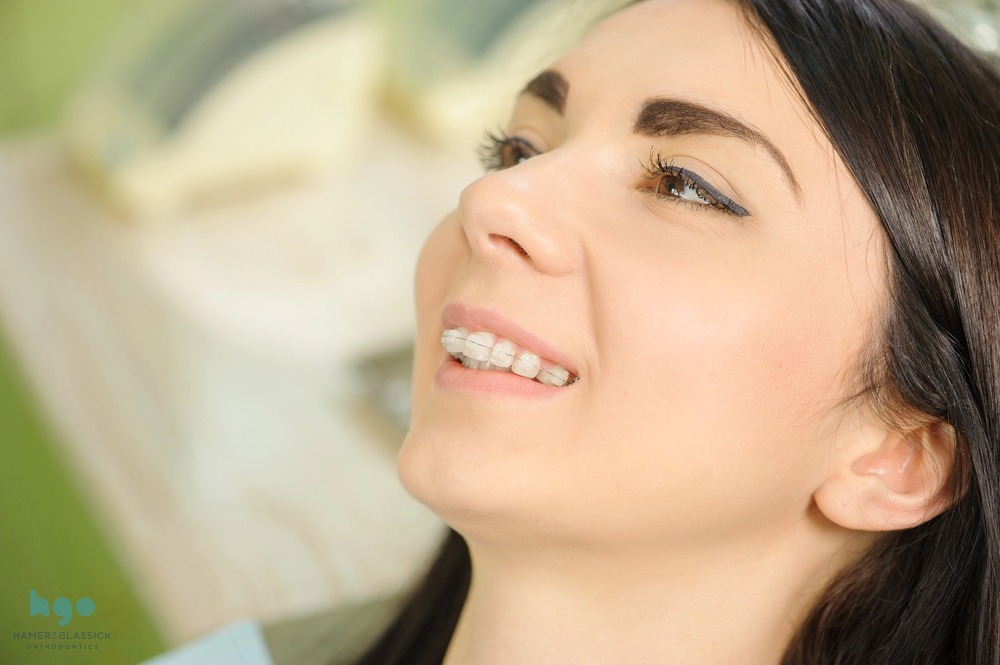 Smiling woman leaning back in a dental chair during a check-up - Overbite vs Underbite in Charlottesville, VA.