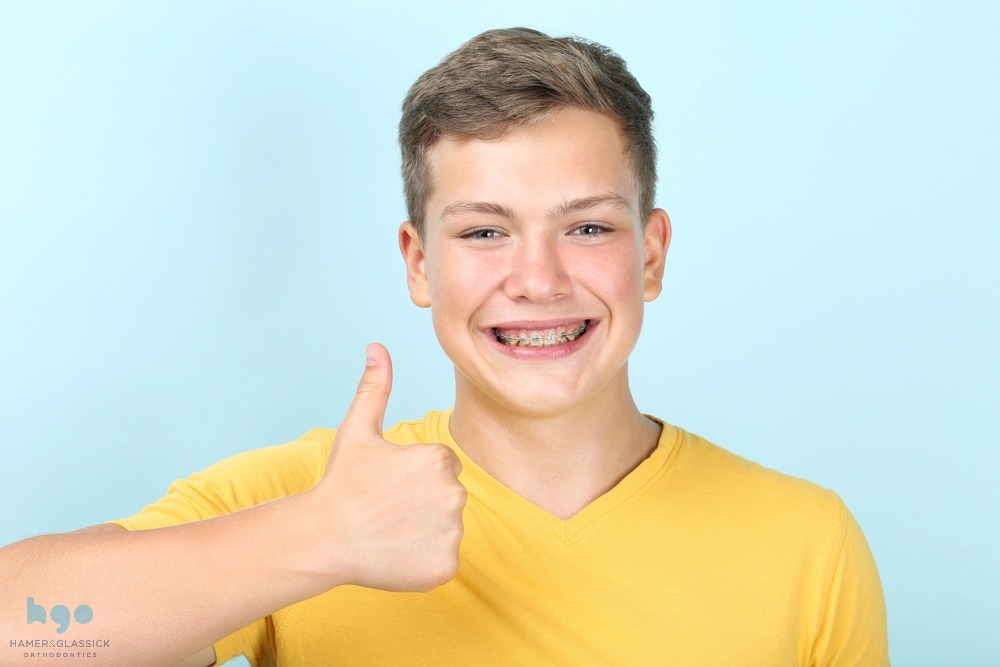 young man with metal braces showing thumb up on blue background - How to Get Braces Glue Off Teeth in Charlottesville, VA