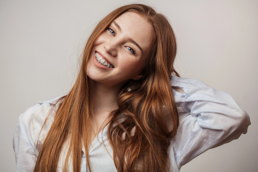 happy young red haired woman in clear braces smiling - Clear Braces vs Metal Braces in Charlottesville, VA